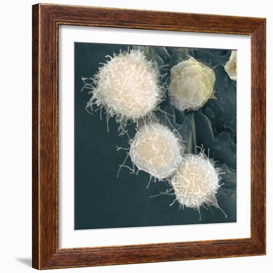 Stem Cells, SEM-Science Photo Library-Framed Premium Photographic Print