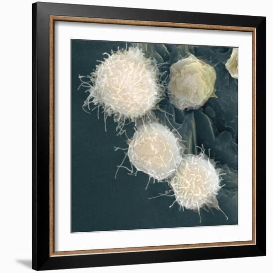 Stem Cells, SEM-Science Photo Library-Framed Premium Photographic Print