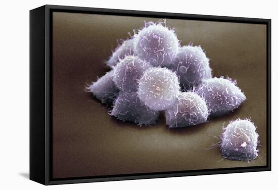 Stem Cells, SEM-Science Photo Library-Framed Premier Image Canvas