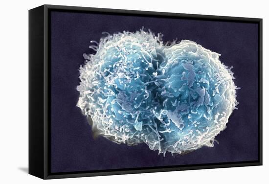 Stem Cells, SEM-Science Photo Library-Framed Premier Image Canvas
