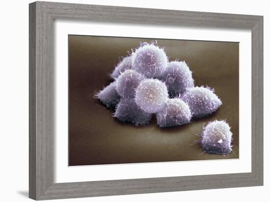 Stem Cells, SEM-Science Photo Library-Framed Photographic Print