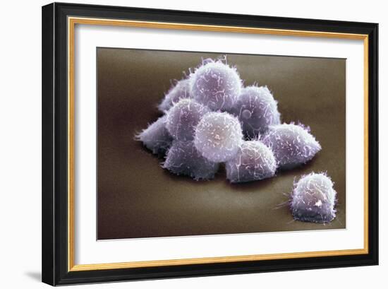 Stem Cells, SEM-Science Photo Library-Framed Photographic Print