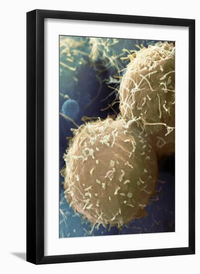 Stem Cells, SEM-Science Photo Library-Framed Photographic Print