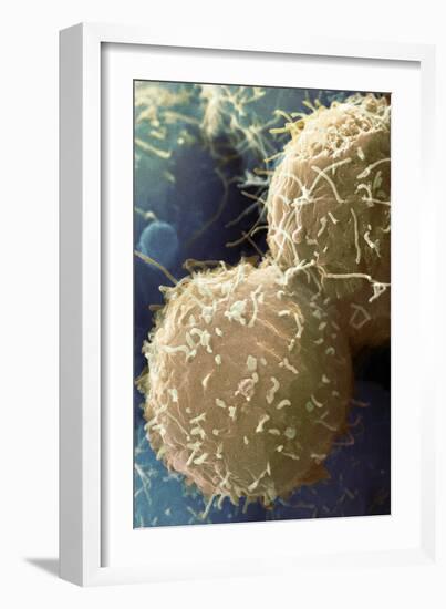 Stem Cells, SEM-Science Photo Library-Framed Photographic Print