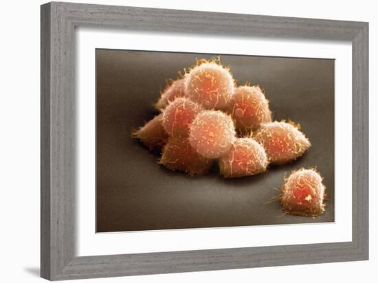 Stem Cells, SEM-Science Photo Library-Framed Photographic Print