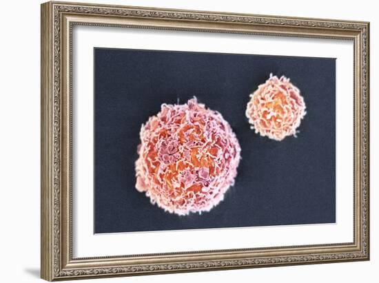 Stem Cells, SEM-Science Photo Library-Framed Photographic Print