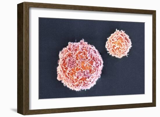 Stem Cells, SEM-Science Photo Library-Framed Photographic Print