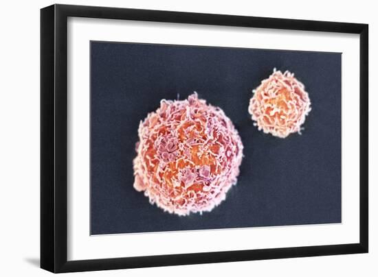 Stem Cells, SEM-Science Photo Library-Framed Photographic Print