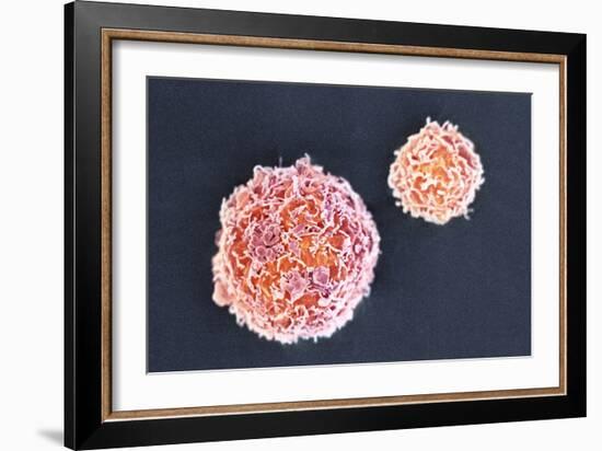 Stem Cells, SEM-Science Photo Library-Framed Photographic Print