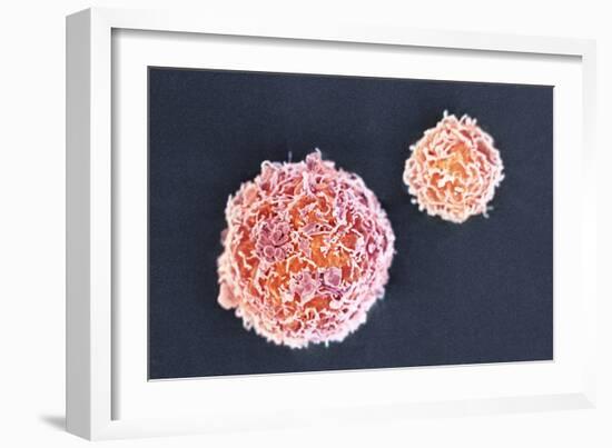 Stem Cells, SEM-Science Photo Library-Framed Photographic Print