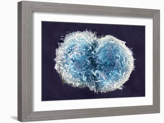 Stem Cells, SEM-Science Photo Library-Framed Photographic Print