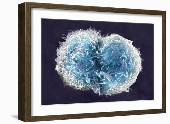 Stem Cells, SEM-Science Photo Library-Framed Photographic Print