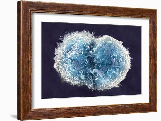 Stem Cells, SEM-Science Photo Library-Framed Photographic Print