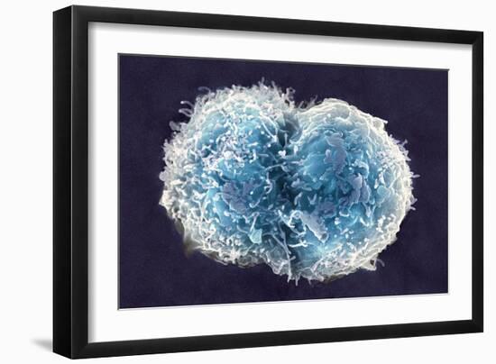 Stem Cells, SEM-Science Photo Library-Framed Photographic Print