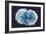 Stem Cells, SEM-Science Photo Library-Framed Photographic Print