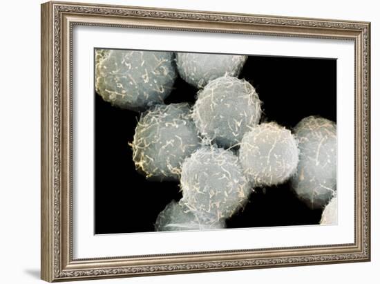 Stem Cells, SEM-Science Photo Library-Framed Photographic Print