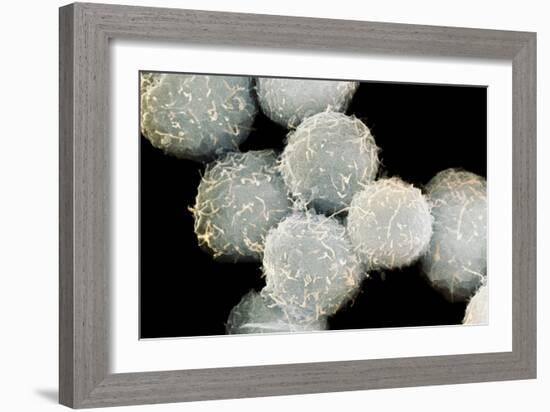 Stem Cells, SEM-Science Photo Library-Framed Photographic Print