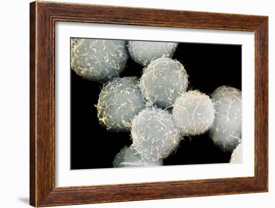 Stem Cells, SEM-Science Photo Library-Framed Photographic Print