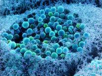Col. SEM of Eye Melanocyte Cell & Pigment Granules-Steve Gschmeissner-Photographic Print