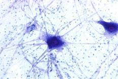 Nerve Cells, Light Micrograph-Steve Gschmeissner-Photographic Print