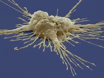 T Lymphocytes And Cancer Cell, SEM-Steve Gschmeissner-Photographic Print