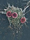 T Lymphocytes And Cancer Cell, SEM-Steve Gschmeissner-Photographic Print
