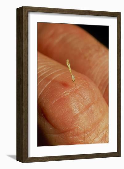 Sting of a Honeybee Embedded In a Human Finger-Dr. Jeremy Burgess-Framed Photographic Print