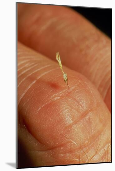 Sting of a Honeybee Embedded In a Human Finger-Dr. Jeremy Burgess-Mounted Photographic Print