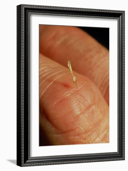 Sting of a Honeybee Embedded In a Human Finger-Dr. Jeremy Burgess-Framed Photographic Print