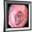 Stomach Ulcer-David Martin-Framed Photographic Print