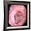 Stomach Ulcer-David Martin-Framed Photographic Print