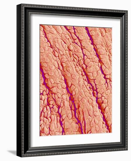 Surface of a valve of a rat heart-Micro Discovery-Framed Photographic Print