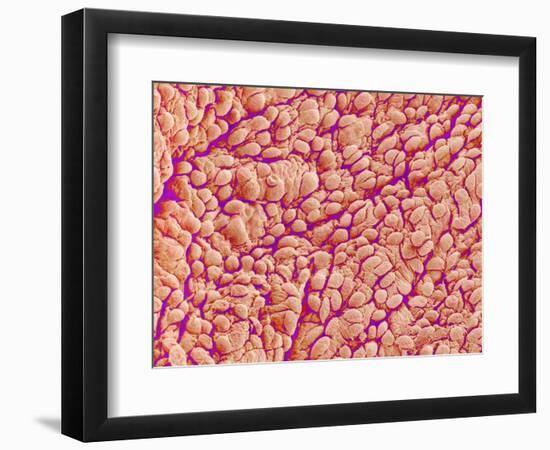 Surface of a valve of a rat heart-Micro Discovery-Framed Photographic Print