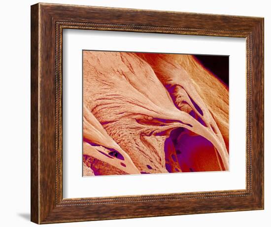 Surface of a valve of a rat heart-Micro Discovery-Framed Photographic Print