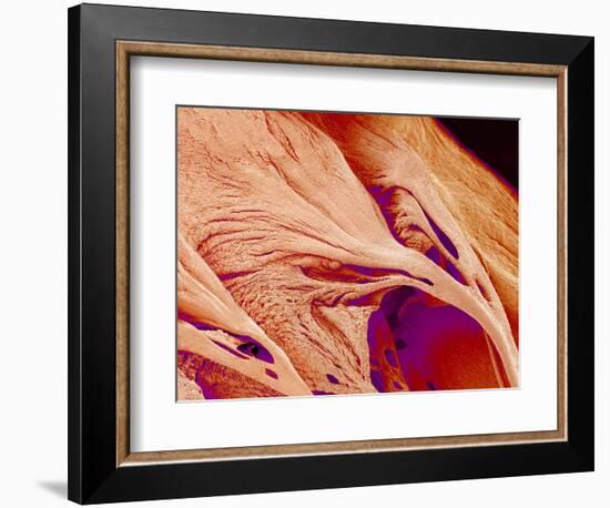 Surface of a valve of a rat heart-Micro Discovery-Framed Photographic Print