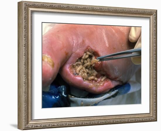 Surgeon Placing Maggots In a Wound To Clean It-Volker Steger-Framed Photographic Print