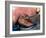 Surgeon Placing Maggots In a Wound To Clean It-Volker Steger-Framed Photographic Print