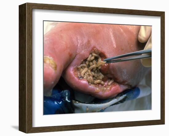Surgeon Placing Maggots In a Wound To Clean It-Volker Steger-Framed Photographic Print