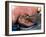 Surgeon Placing Maggots In a Wound To Clean It-Volker Steger-Framed Photographic Print