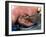 Surgeon Placing Maggots In a Wound To Clean It-Volker Steger-Framed Photographic Print