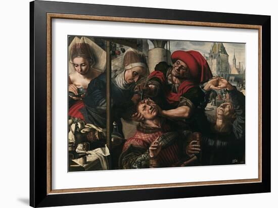 Surgery, 1550-1555-Jan Sanders van Hemessen-Framed Giclee Print