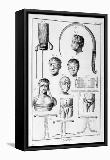 Surgery, 1751-1777-Denis Diderot-Framed Premier Image Canvas