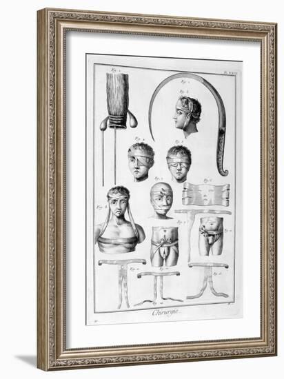 Surgery, 1751-1777-Denis Diderot-Framed Giclee Print