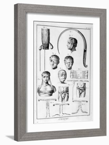 Surgery, 1751-1777-Denis Diderot-Framed Giclee Print