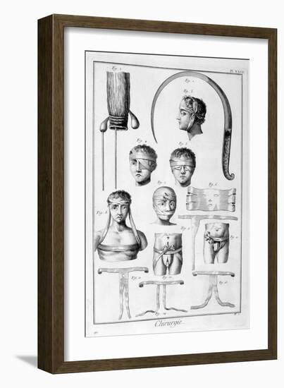 Surgery, 1751-1777-Denis Diderot-Framed Giclee Print