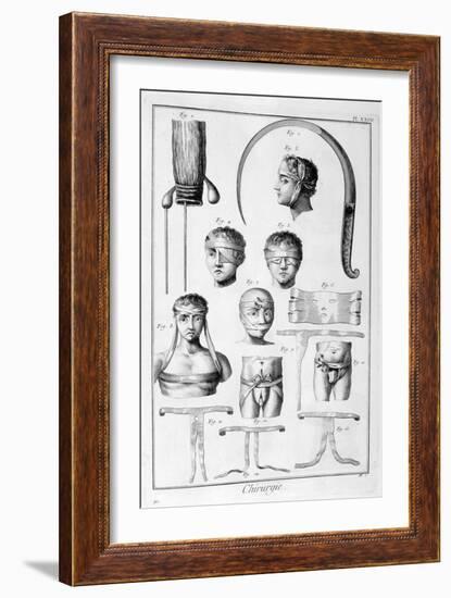 Surgery, 1751-1777-Denis Diderot-Framed Giclee Print