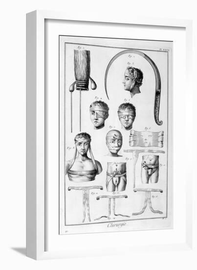 Surgery, 1751-1777-Denis Diderot-Framed Giclee Print