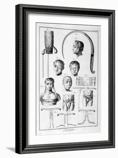 Surgery, 1751-1777-Denis Diderot-Framed Giclee Print