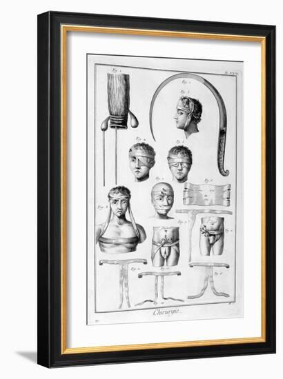 Surgery, 1751-1777-Denis Diderot-Framed Giclee Print