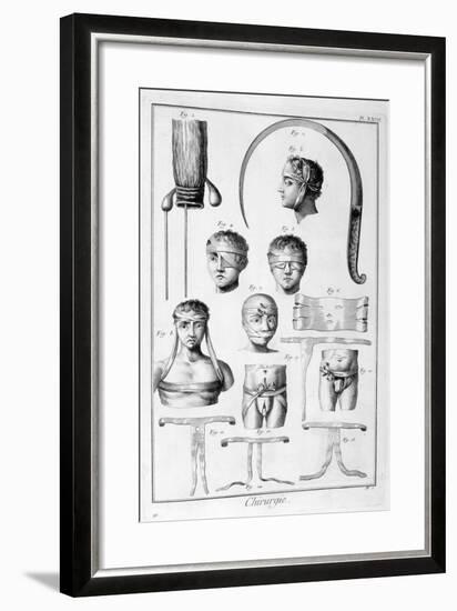 Surgery, 1751-1777-Denis Diderot-Framed Giclee Print